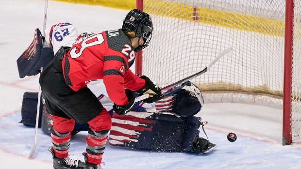 Canada defeats the United States of America to reduce the difference in the American rivalry series to 3-1