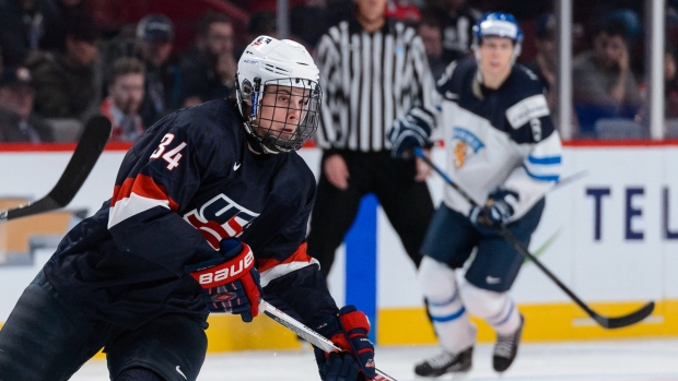 Gold on the Mind: Auston Matthews looking forward to first Olympic