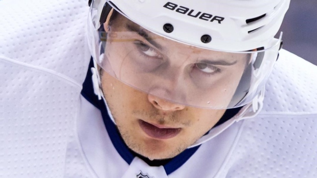 Maple Leafs' Auston Matthews leaves game with shoulder injury